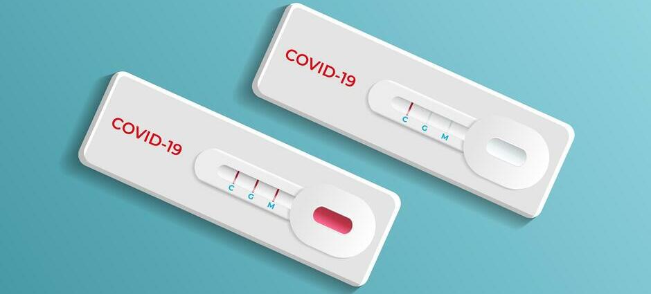 Testes para covid-19: conheça os diferentes tipos e saiba como fazer -  Estadão