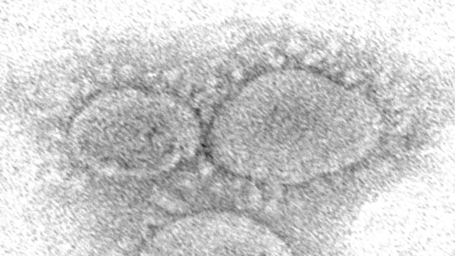 Fotografia do novo coronavírus ao microscópio eletrônico
